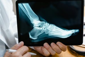 Fall Prevention